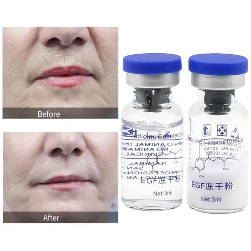 Lyophilized Epidermal фактор роста EGF 2 шт. порошковая Сыворотка для лечения акне прыщей