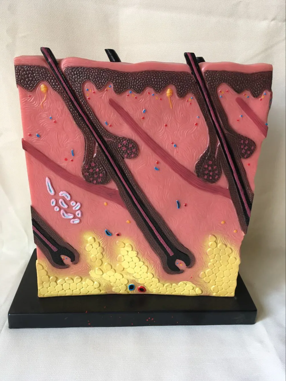 Quality PVC Human Skin Anatomical Model Acne Epidermis Anatomy Pathological Medical Teaching 34X34X16CM | Канцтовары для офиса и