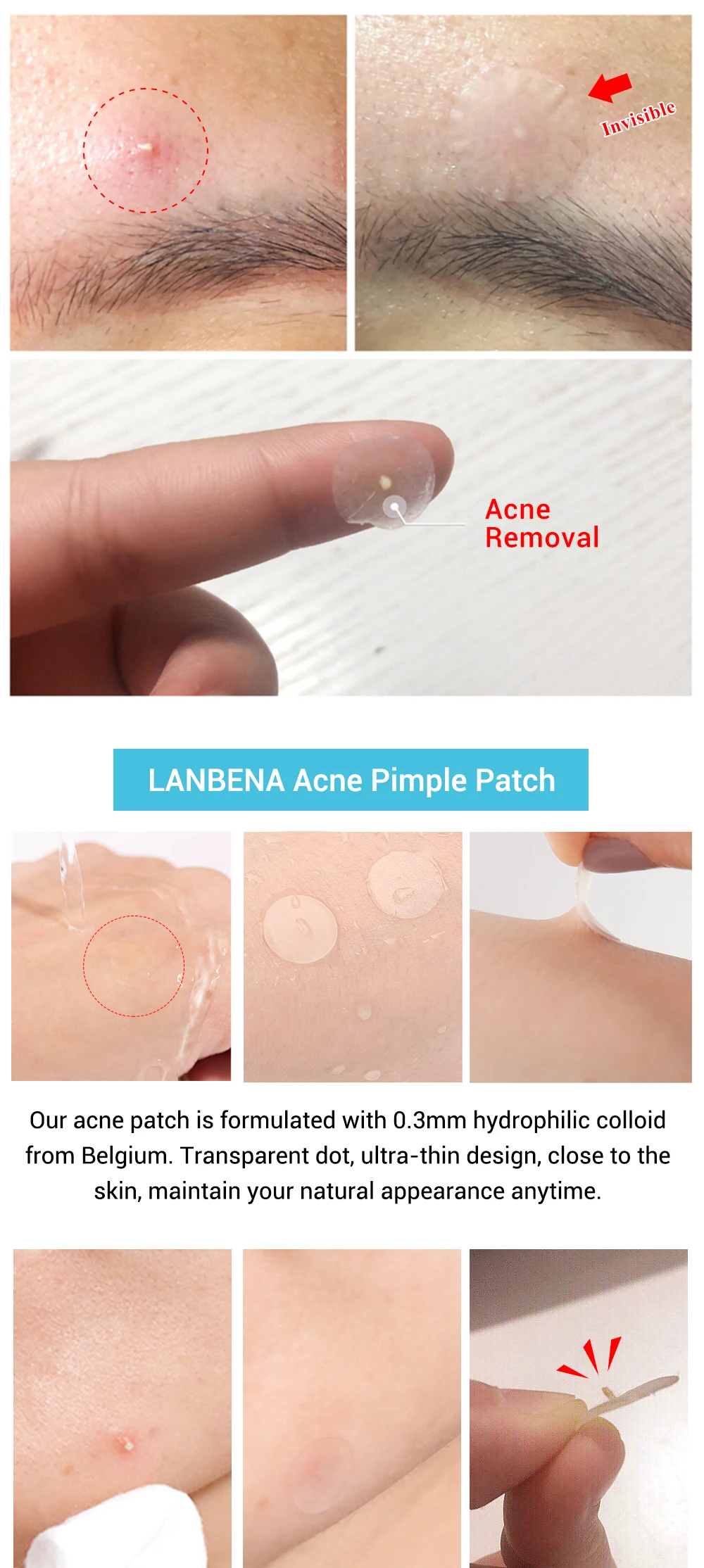 LANBENA прыщи, пластырь, невидимые наклейки для лечения прыщей, средство для удаления прыщей, средство для ухода за кожей