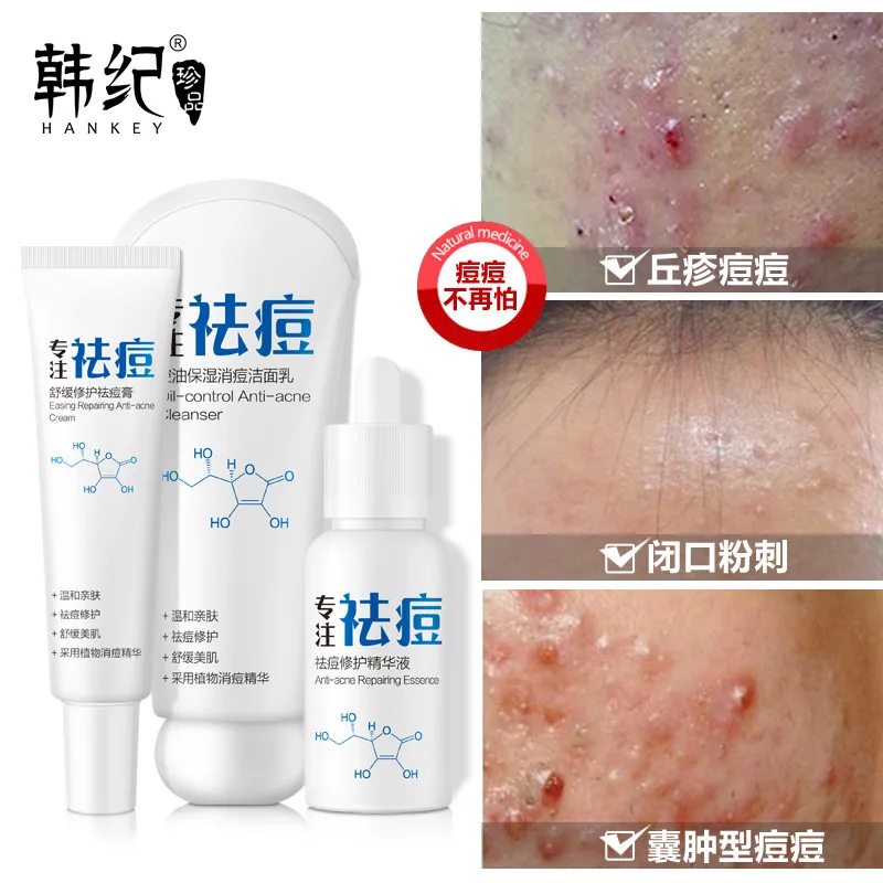 

Салициловая кислота, гиалуроновая кислота, акне, шрам, крем для лица, особенно для женщин, лечение акне, наборы, уход за кожей с сывороткой дл...