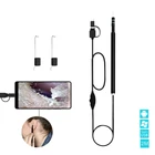 USB-эндоскоп, визуальная ухочистка, многофункциональный ухочистка, стоматологические инструменты для чистки зубов, отоскоп, медицинский уход за здоровьем