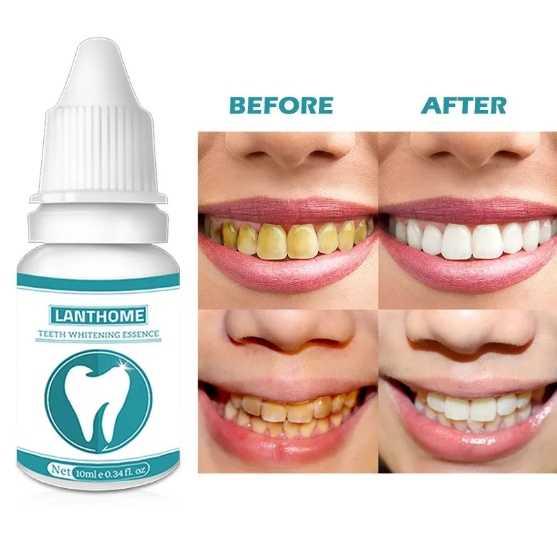 Отбеливание зубов эссенция гигиена полости рта Чистящая сыворотка желтые пятна