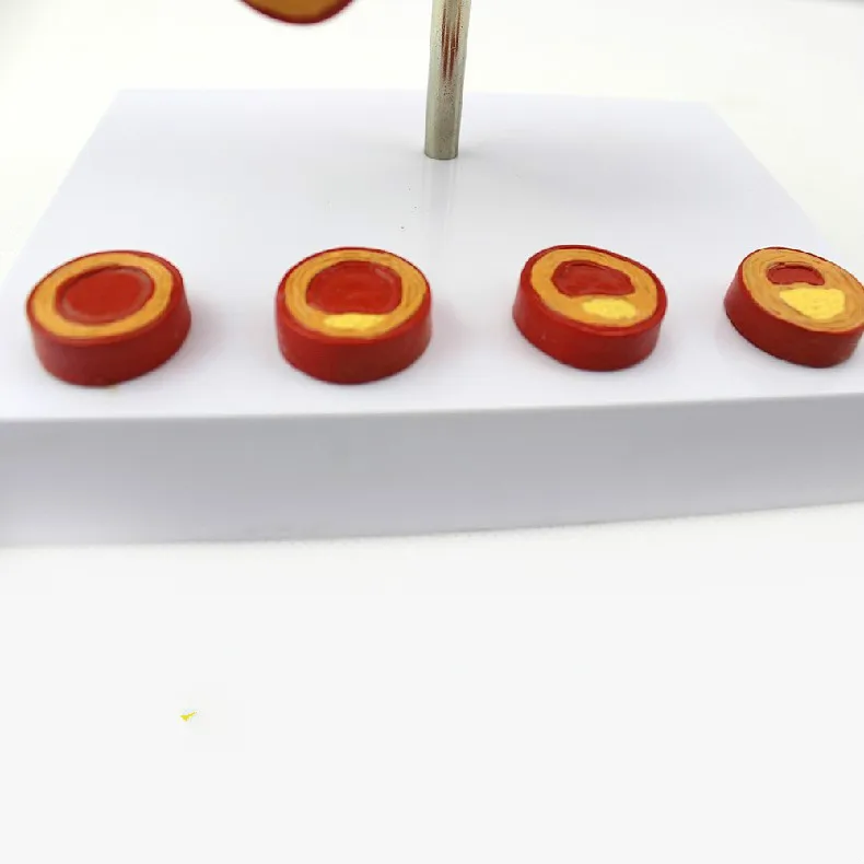 10 кратное увеличение человеческой артериальной коронарной артериологии