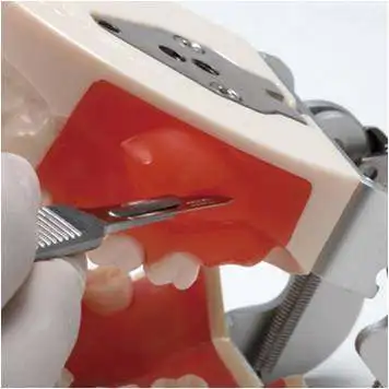 

Incision of abscess of oral practice and model of alveolar abscess incision and drainage