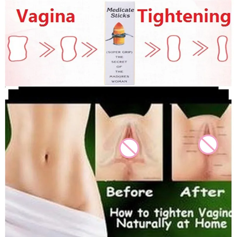 Необычные чувство вагинальные усадки укрепляющий влагалище средства ухода за