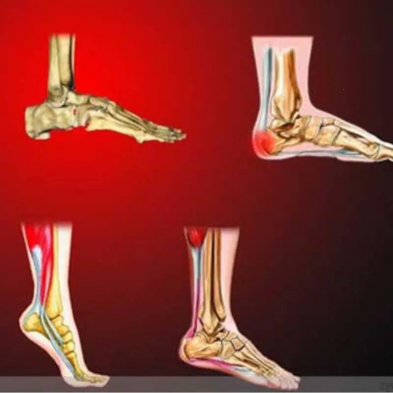 8 шт./пакет боль в пятке Пластырь от боли рельеф травяной костной Шпоры Ахиллес