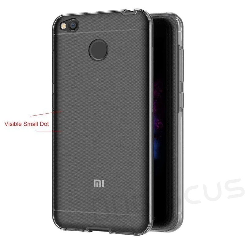 Для Xiaomi Mi A1 5X 360 градусов корпус полное покрытие защита Мягкий ТПУ чехол Redmi 5 Plus 4A