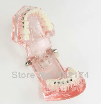 

Free Shipping Halfmetal halfcemeric orthodontics model dental tooth teeth dentist dentistry odontologia Tyodont Model