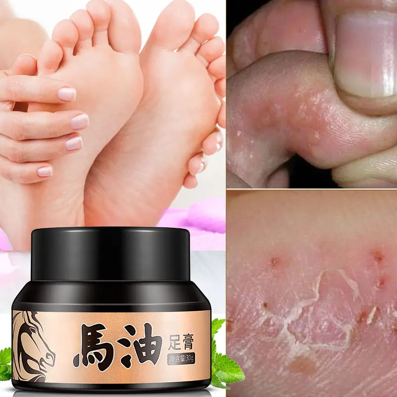 Ручной крем для ног на потрескавшуюся кожу шелушение Исцеление анти сухой