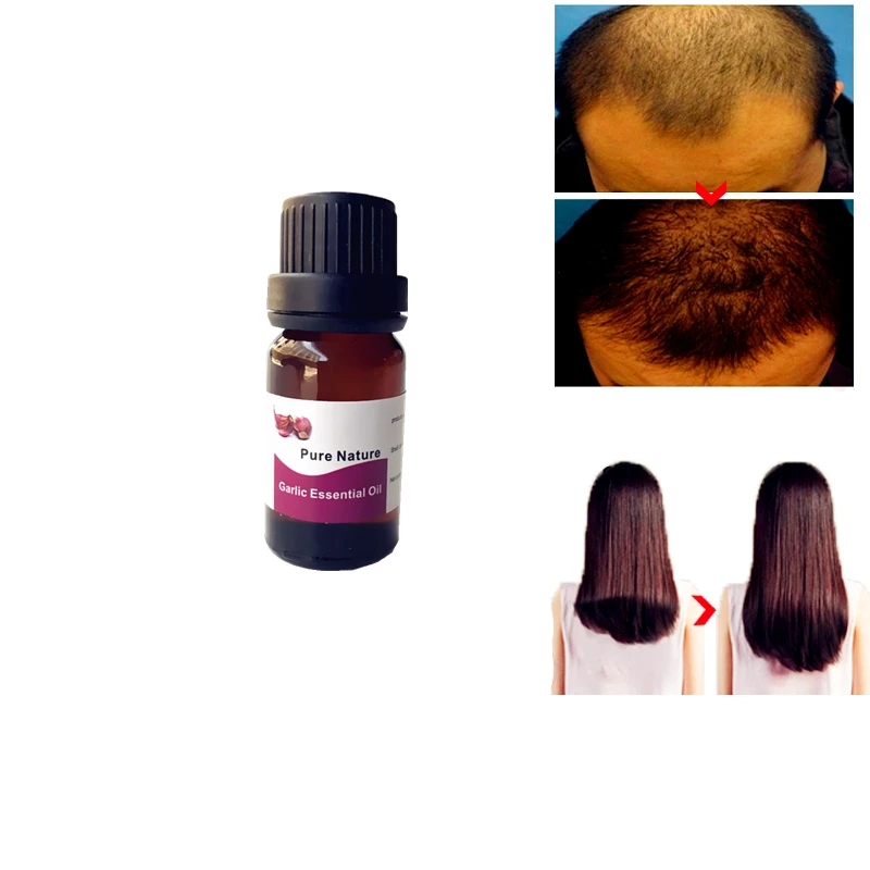 

10ml Garlic Dry And Maintenance Hair Nutrition Essential Oil Treatment Essence Fast Hair Growth Liquid Hair Loss Products