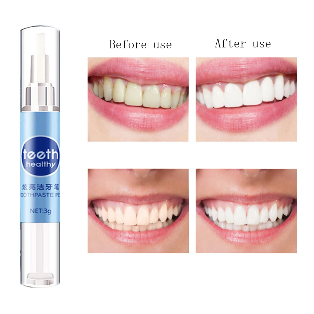 1 шт. креативная эффективная ручка для отбеливания зубов зубной гель ластик Hyun White