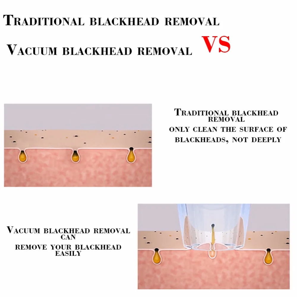 2 Цвета вакуумный Черноголовых всасывания удаления прыщей уход за кожей