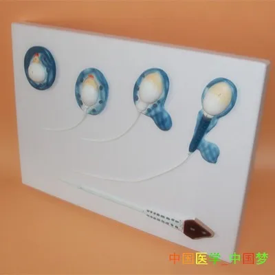 

sperm Development process model Male Reproduction Sperm structure Anatomy amplification model free shipping