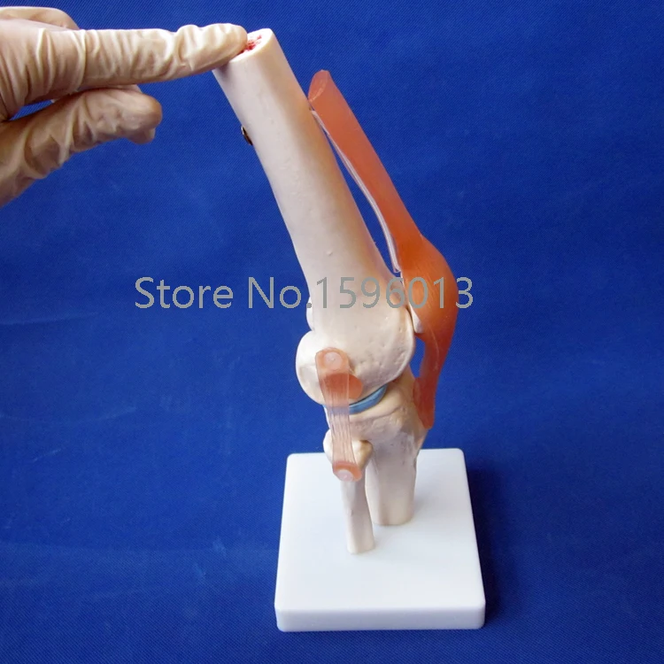 Популярная модель коленного сустава в натуральную величину анатомической