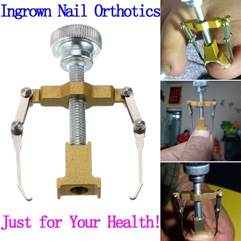 Изгиб объем ногти подтяжки Поддержка Маникюр носок паронихия гвоздь бандаж