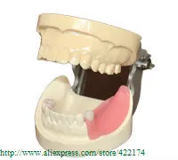 

Free Shipping Implant practice model and caries dental tooth teeth dentist anatomical anatomy model odontologia