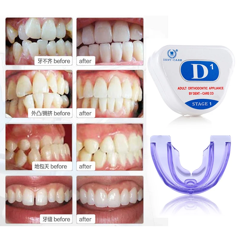 Myobrace зубные ортодонтические брекеты виниры антимолярные Ортодонтические