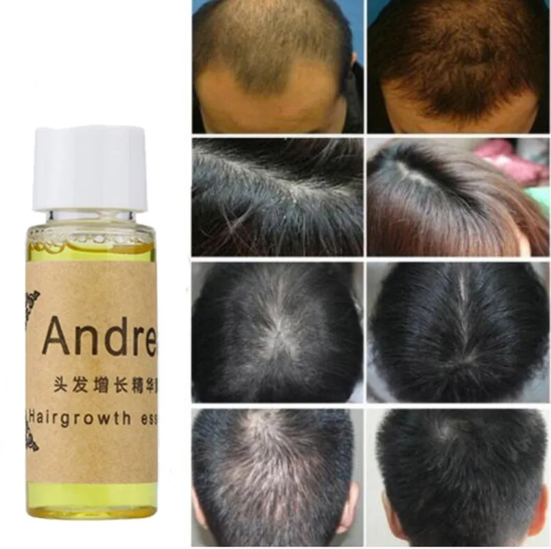 Andrea Hair Growth Жидкость против выпадения волос 20 мл натуральный экстракт с натуральным восстанавливанием волос быстро, гуще, Andrea Hair Growth Oi