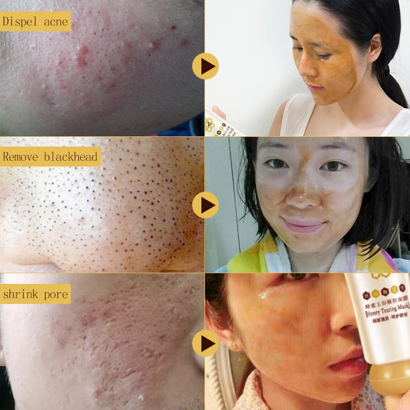 Маска для удаления черных точек и омертвевшей кожи 60 г|Средства ухода маски| |