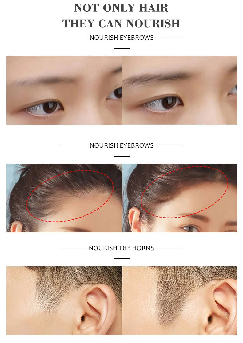 Hair Growth Development Essence Anti-hair loss Hair Care Deep Nourishment Hair Conditioner Essential oil 30ml