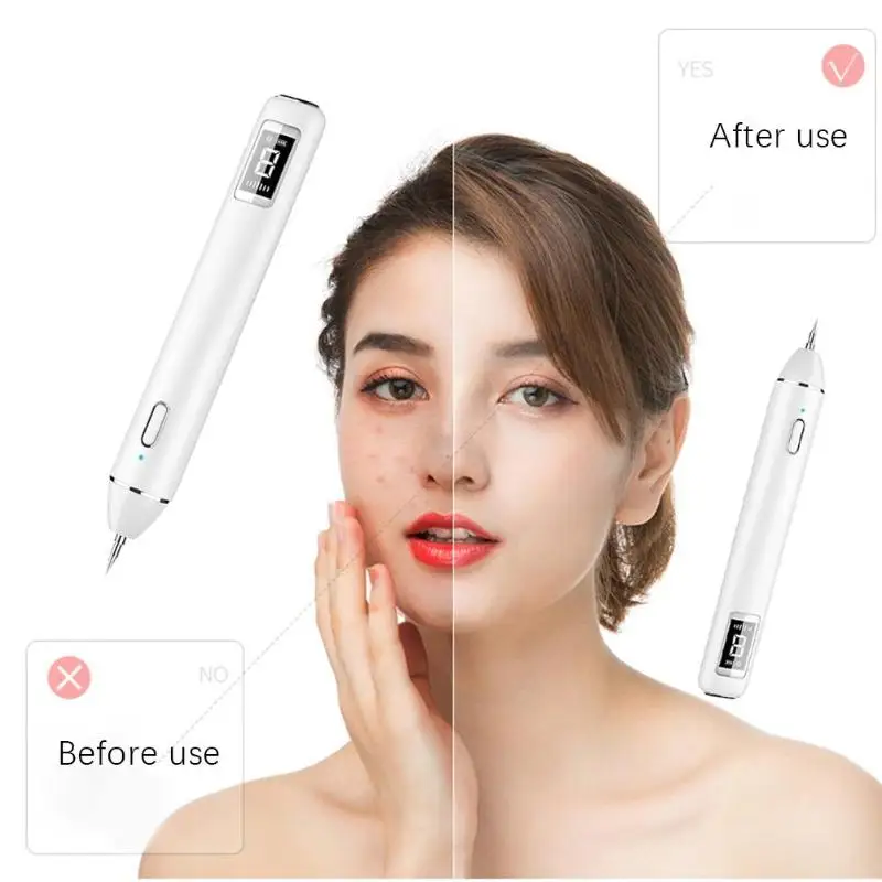 8 уровень lcd Лазерная плазменная ручка веснушки темное пятно удаление татуировок Лазерная моль удаление бородавки уход за кожей лица машина