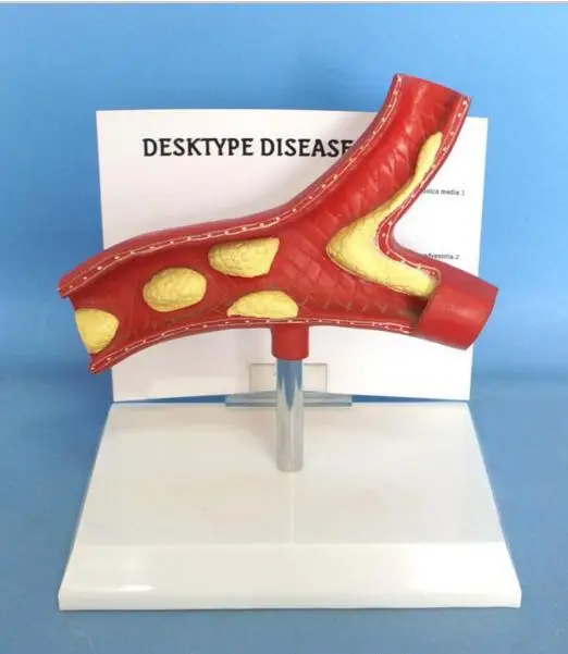 Модель больного сосуда анатомия сосудов ранняя модель Миксер Для травм для