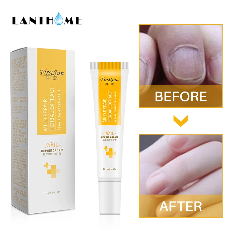 Крем для лечения грибка пальцев ног онихомикоз пароникья анти грибковый