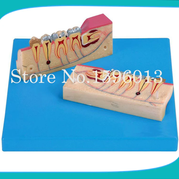 Dissected Model of Teeth Tissue,Teeth tissue decomposition model,Teeth Organizational Model