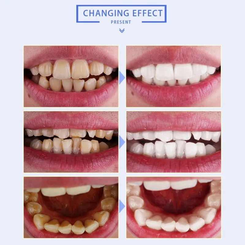 Прямая поставка 20 мл эссенция чайное дерево осветление зубов масло жидкость