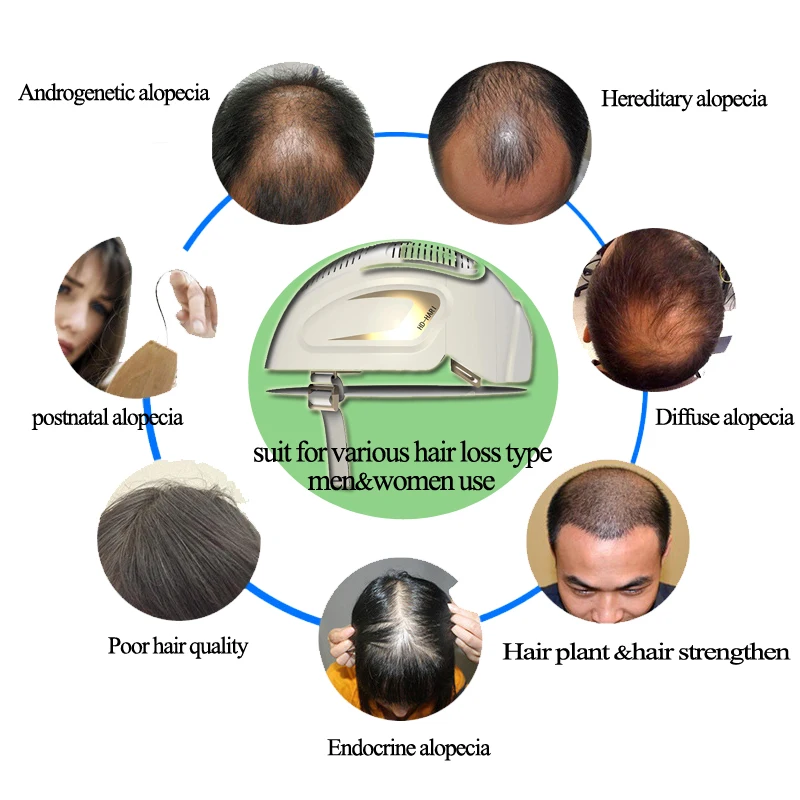 Лазерный шлем SIDEY для роста выпадения волос медицинские диоды лечение быстрое