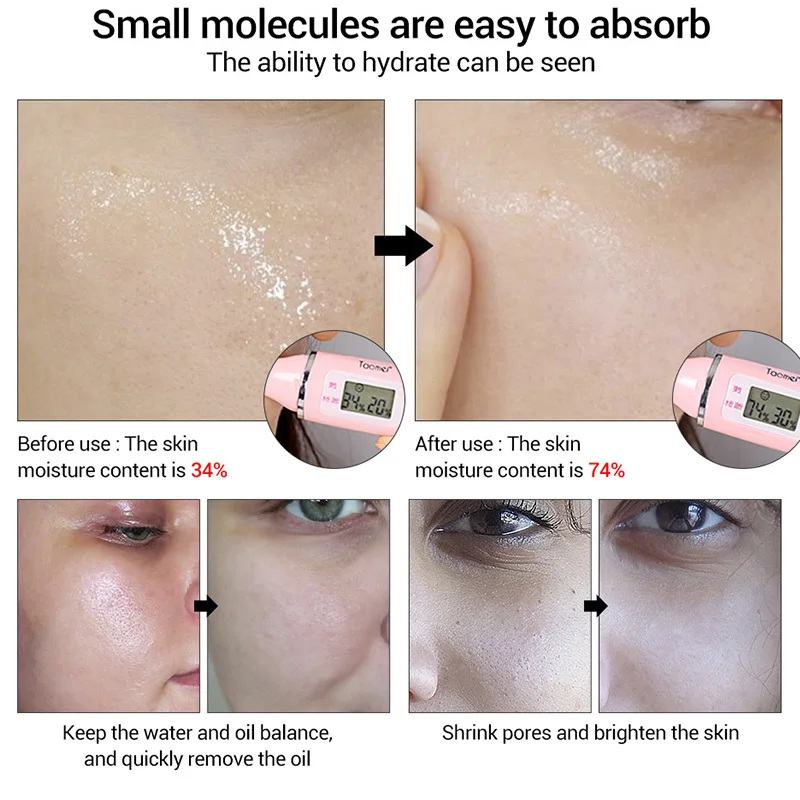 LANBENA Гиалуроновая кислота Улитка Сыворотки лицо Сущность отбеливание против