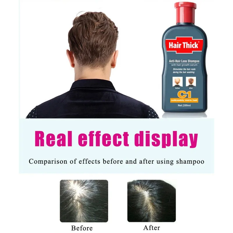 100ml C1 Anti-hair Loss Shampoo with Hair Growth Serum Unisex Products Oil Control Anti-dandruff Relieve Itching | Красота и здоровье