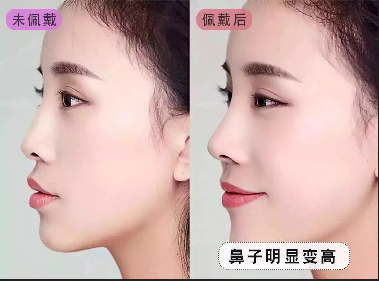 Beauty nose artifact nose bridge elevator female nose clip augmentation nose pad stiffener nose warping correction