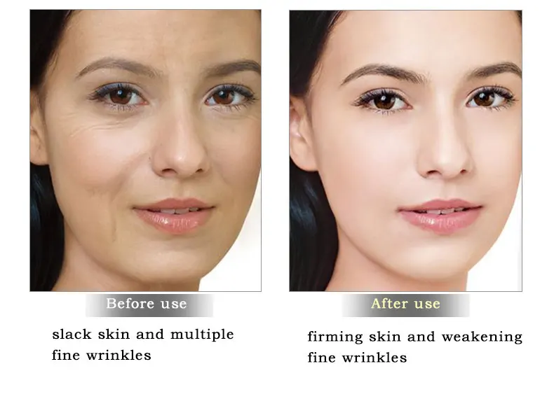 ARTISCARE Snail восстановление и отбеливание крем для лица дневной крем против морщин против старения лечение акне, увлажнение, укрепляющий уход за кожей
