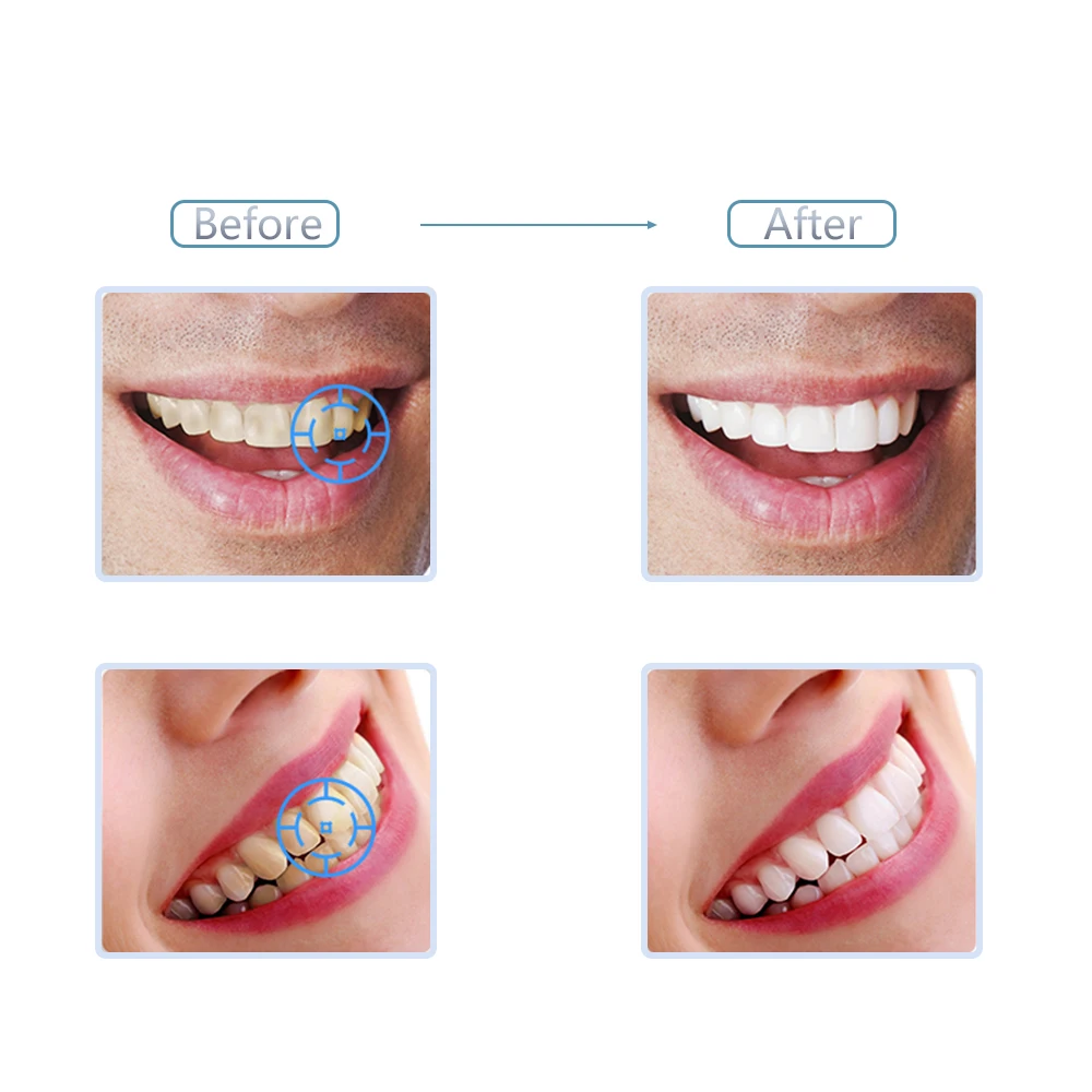 Порошок для отбеливания зубов GENKENT отбеливающий порошок очищающая упаковка