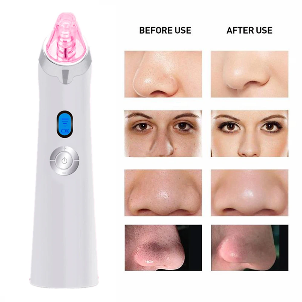 Электрический 3 вида цветов для чистки лица многофункциональный вакуумный отсос