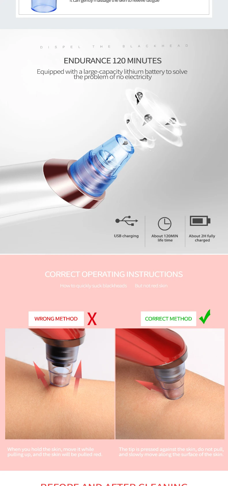 Прыщи Приспособления для красоты вакуумный отсос угрей Remover лица пор очищающее средство от черных точек Acne прибор для удаления угрей спа машина черные точки акне для лица для чистки лица удаление угрей