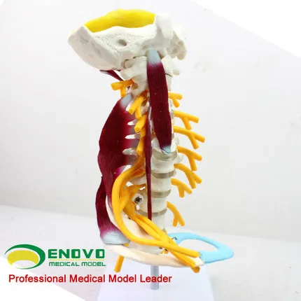 

Medical human cervical model brachial plexus neuromuscular model human skeletal specimen model