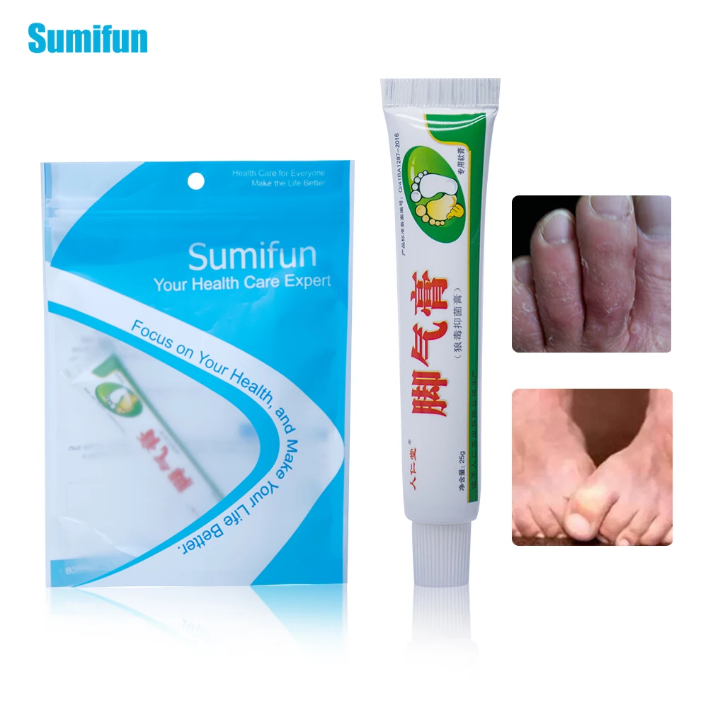 Sumifun, 1 шт., мягкая мазь, Китайский крем для ног, для ног спортсмена, зуд, мозоли, пилинг, эзофагит, берибери, плохой очиститель для ног P1005