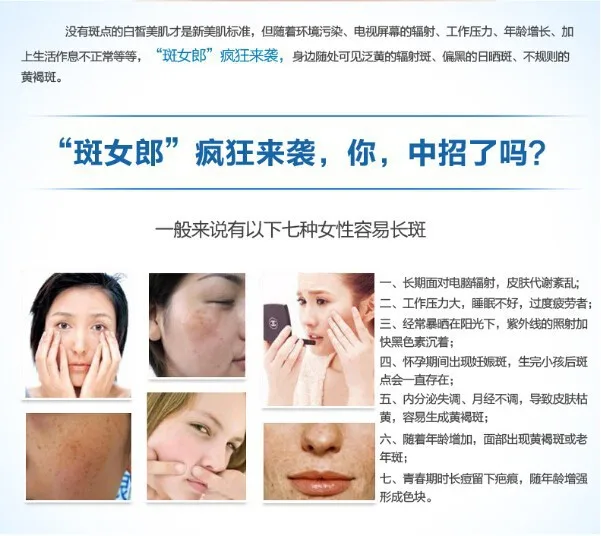 2N 28 days Medicated Pigment Skin Whitening Cream Chloasma Cyasma Melanin Removing freckle speckle Firm skin care face care