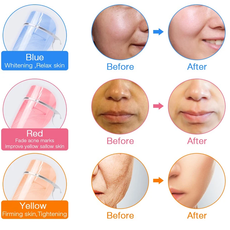 2 цвета светодиодсветильник вая терапевтическая маска для лечения акне PDT