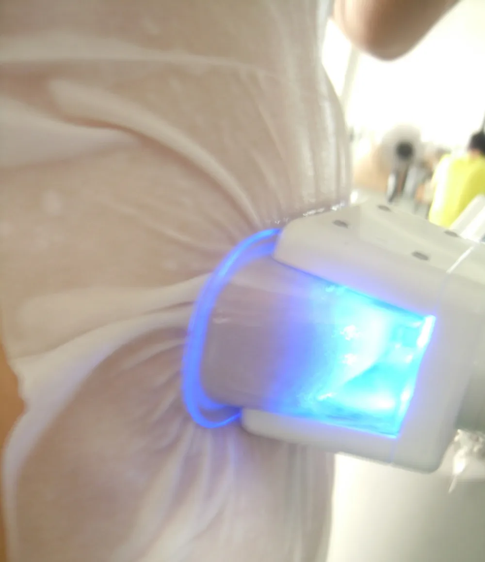 Оптовая продажа 50 шт./пакет cryolipolysis мембраны антифриза для криотерапии