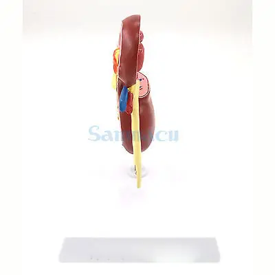 Модель болезненной почки человеческий анатомический медицинский образец