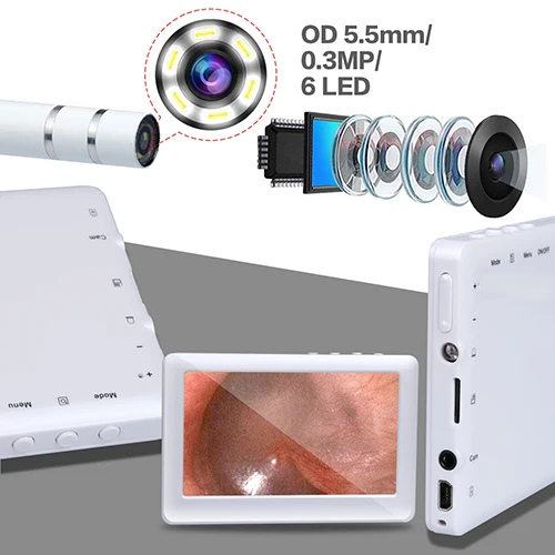 Визуальная Ушная Очищающая ложка Otoscope 5 мм объектив 6 светодиодный эндоскоп с 4