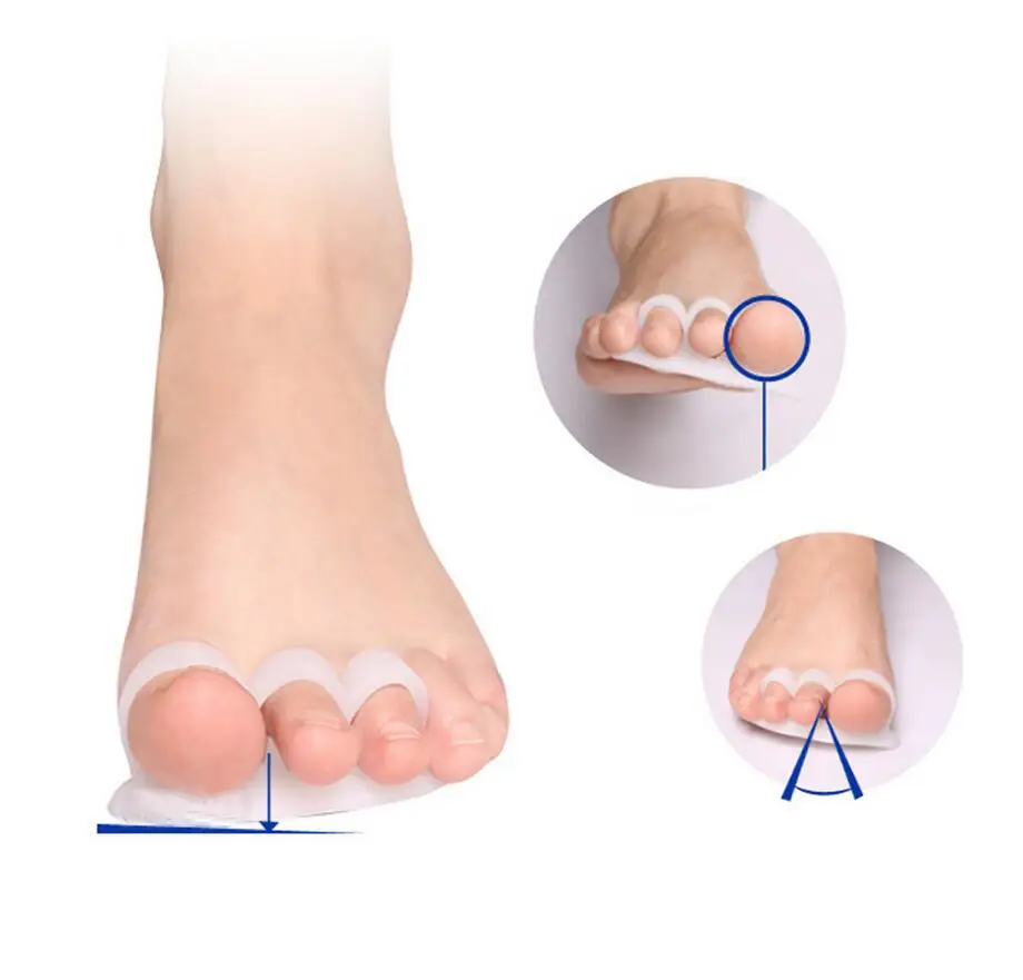 1 пара мягкая Зубчатая Дробилка костный эктропион для пальцев ног внешний прибор