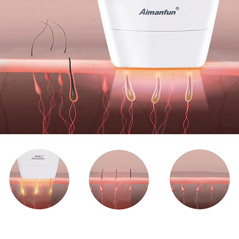 Epilator Depilator Facial Body Permanent Hair Removal Device IPL 300000 Pulses MH88 | Красота и здоровье