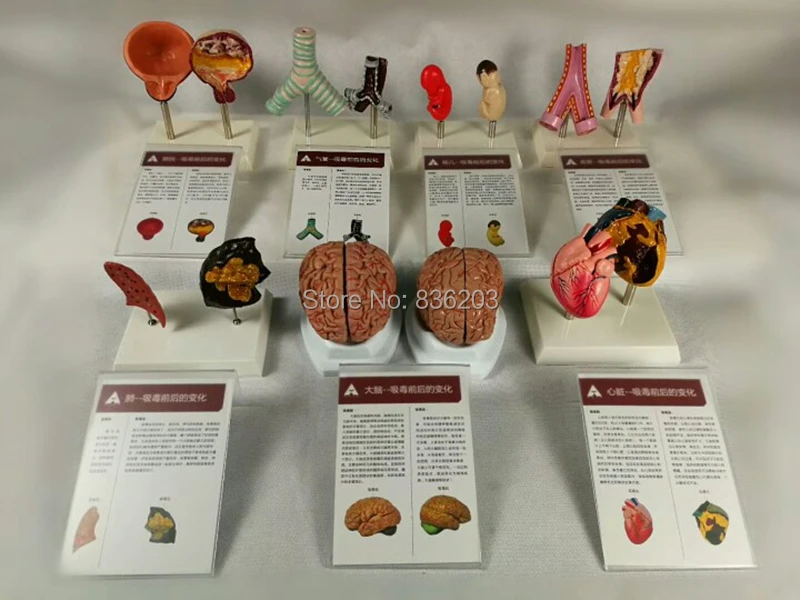 Медицинский шприц для обучения при раке легких|lungs model|human lung modelmodel lungs |
