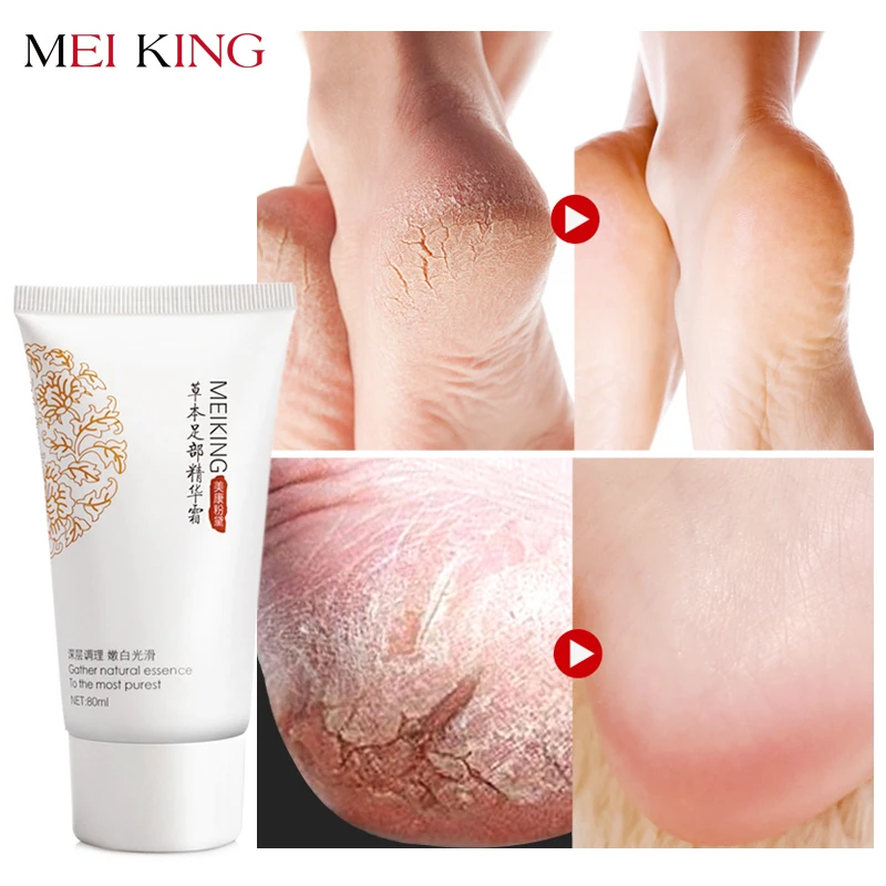 MEIKING Baby Foot Care Глубокий Пилинг для ног кожуру анти сушки удалить мертвую кожу ног лосьон Отшелушивающий крем для ног маска 80г