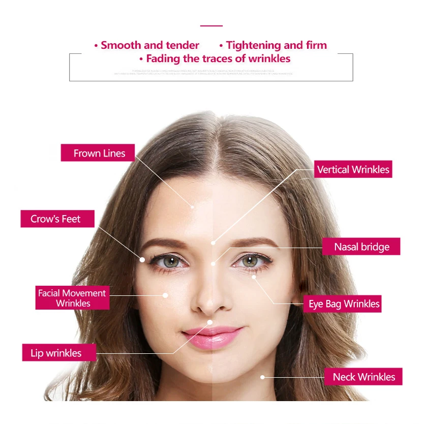 Умный RF Beauty аппарат для лифтинга кожи лица омоложение Вибрационный массажер