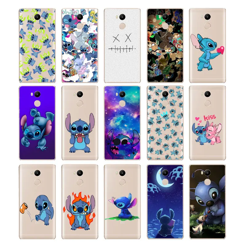 DREAMFOX M355 Stitch Soft TPU Silicone Case Cover For Xiaomi Redmi Note 3 4 5 Plus 3S 4A 4X 5A Pro Global |